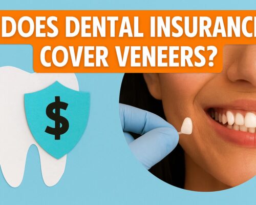 Does Dental Insurance Cover Veneers? Complete 2025 Coverage Guide